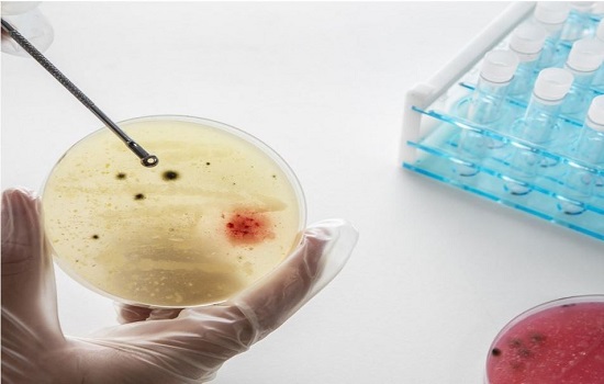 There is an image here